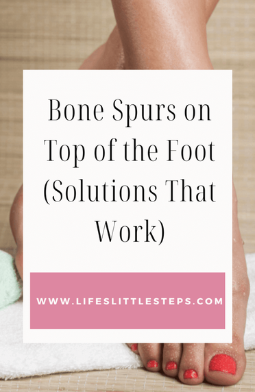 Bone spur on top outlet of foot natural remedies