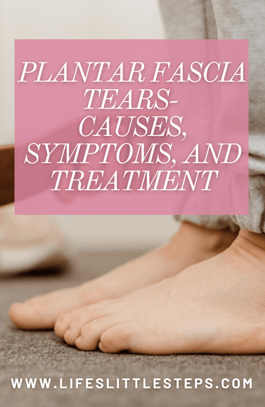 Ruptured plantar fascia physical sale therapy