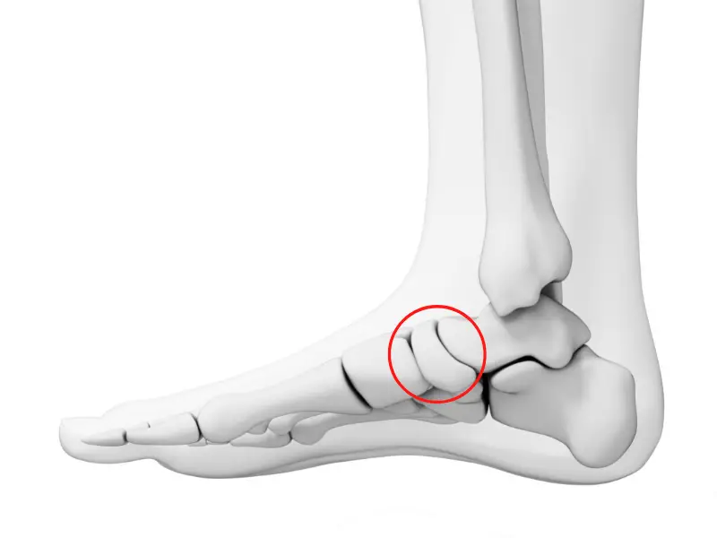 Navicular Fractures- What You Need to Know